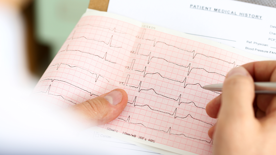 EKG Technician's hands holding paper results